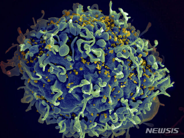 성병 HSV-2형 환자수 10년간 증가세…임질 및 클라미디아 감염증 감소