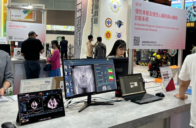 “만성 뼈질환 AI 엑스레이로 정밀 진단”