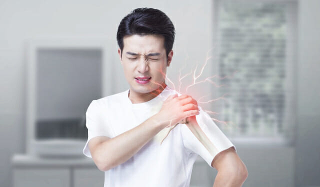 [1분건강] 팔 들때 찌릿 ‘어깨충돌증후군’ 무엇