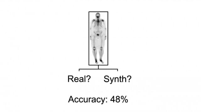 생성형 AI로 만든 가짜 뼈 스캔 영상, 전문의도 속았다
