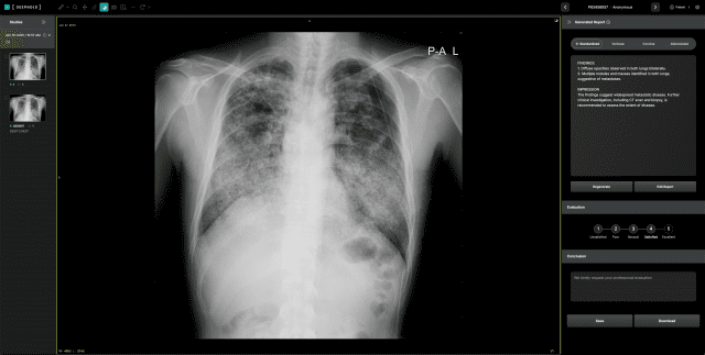 딥노이드, ‘딥시크 R1’으로 자체 생성형AI 모델 업그레이드