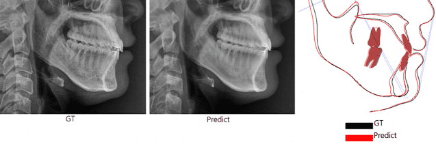 ‘양악수술 후 내 모습’ 미리 보여주는 AI 모델 개발