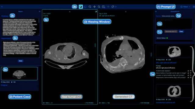 “말 한마디로 CT 촬영 완성”…AI 의사들이 직접 써본 결과는