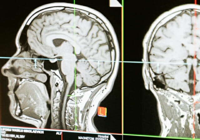 빅파마 탐내는 中 AI 신약 기술 눈길