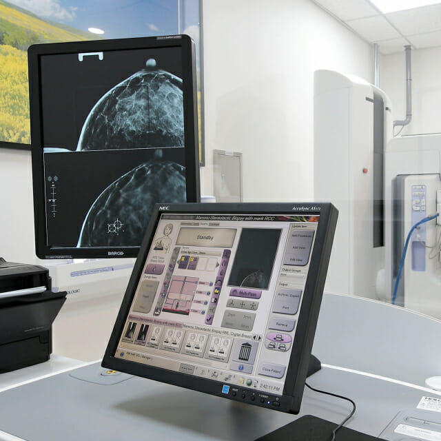 [1분건강] 유전성 유방암 변이 보유자는 25세부터 관리해야