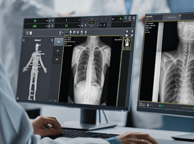 뷰웍스 의료영상 처리 소프트웨어 ‘VXvue’, 미국 FDA 승인 획득