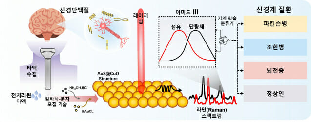 뇌 질환 진단, 침 한 방울이면 끝…정확도 최대 98%